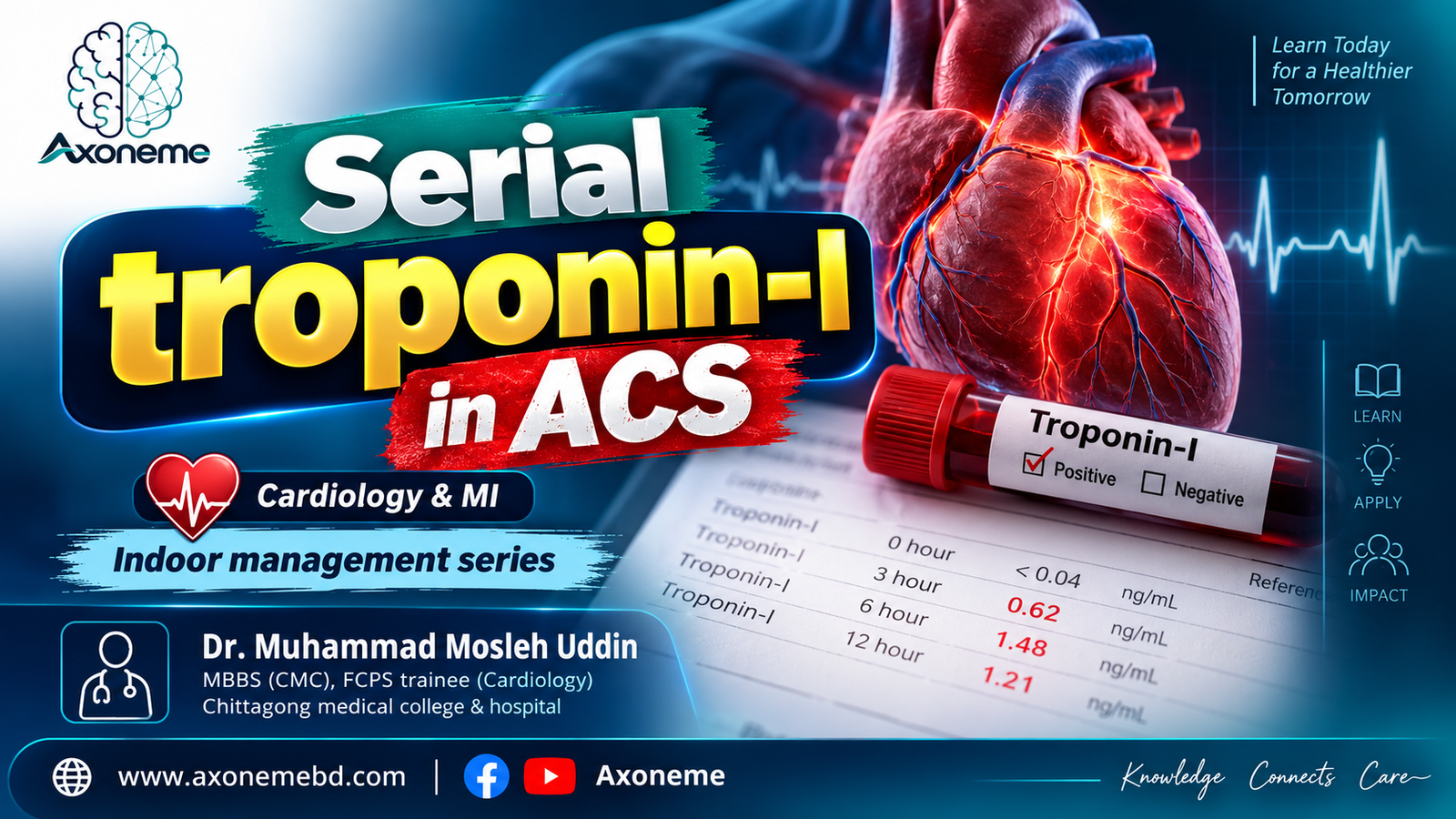 Serial troponin I measurement in ACS